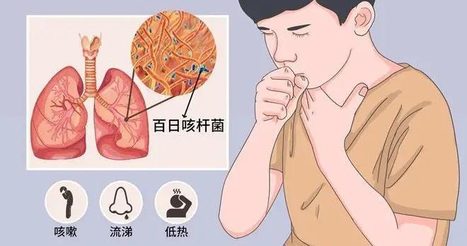 涉及所有婴幼儿！这种疫苗有调整→