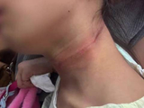 长沙一儿童攀岩被钢丝勒脖！家长怀疑设备故障，园方称系操作不当，警方介入