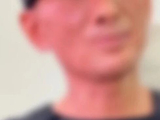 57岁歌手脸部状态触目惊心，看起来像“被烧伤”……个人账号发布视频回应：疤痕系早年意外车祸受伤所致