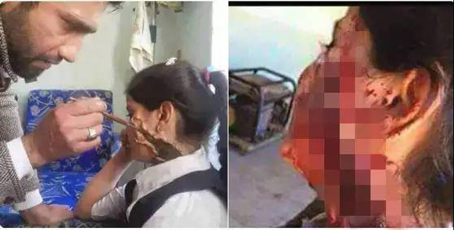 幕后黑手是谁？叙利亚“化武事件”引发的战争打响了