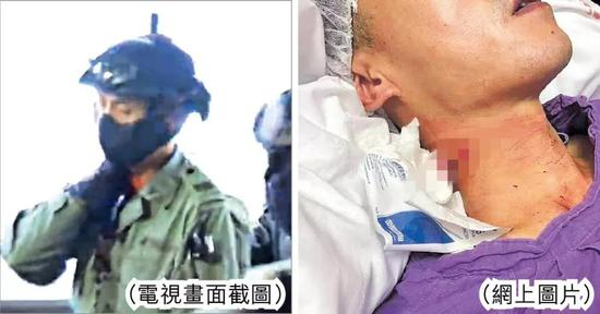 10月13日，一名香港警察在执行任务时遭暴徒割伤颈部&nbsp; 图源：港媒