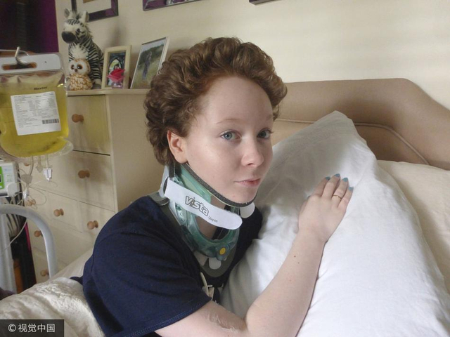 但她却无法享受美食带来的幸福,她患有先天性结缔组织发育不全综合征