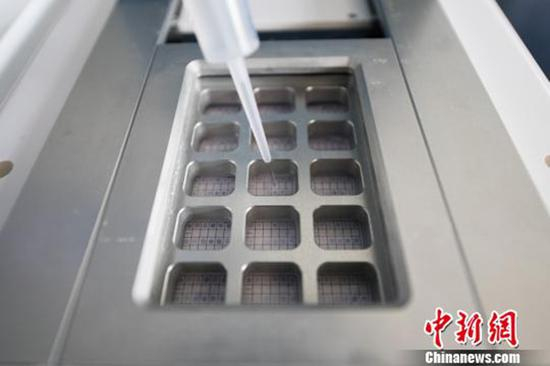  一些严重的遗传性疾病，会造成极高的致残致畸婴儿。 本文图均为 中新网 图