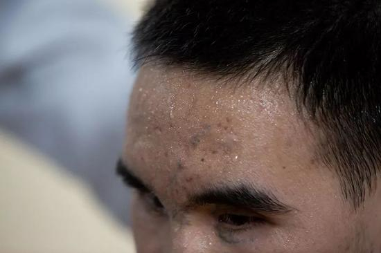 2019年10月24日，杜富国体能康复训练后，满头大汗。新京报记者 李凯祥 摄