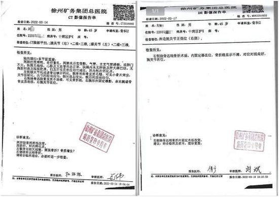 在医院的检查中只报告了骨折