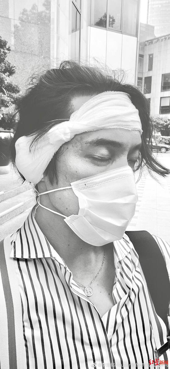 ↑李浩铭受伤害后耳朵打绷带。