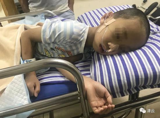  被曾春亮多次击打的7岁男孩远远（摄于远远受伤两周后）