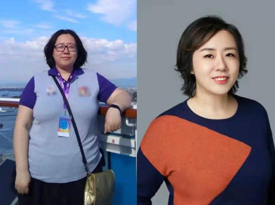 丁蕊手术前后。受访者供图