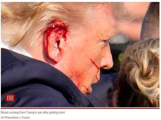 特朗普遭枪击耳朵受伤 图源：美联社