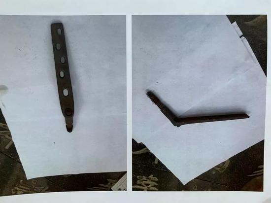 　　▷家属称从骨灰中找到了不同的手术部件