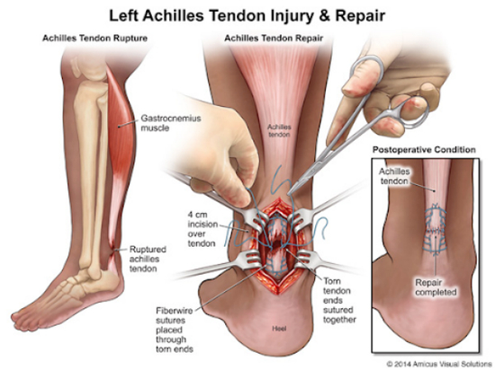 模拟手术治疗（图片来自于网络）