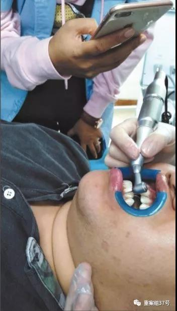  10月24日，培训班老师在一名男学员牙齿上演示如何进行“贴面”操作 。