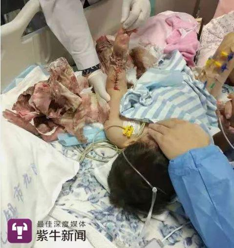 医护人员在给辰辰清理伤口
