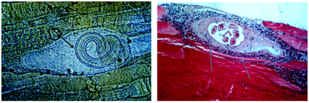 图8. 猪肌旋毛虫压片镜检图像（佘锐萍）图9.猪肌旋毛虫包囊石蜡切片HE染色图象（佘锐萍）