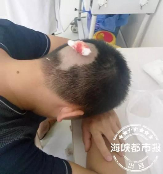 陈先生只好剃掉后面的头发。