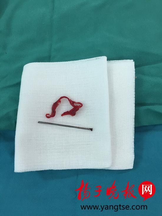 术后取出的钉子