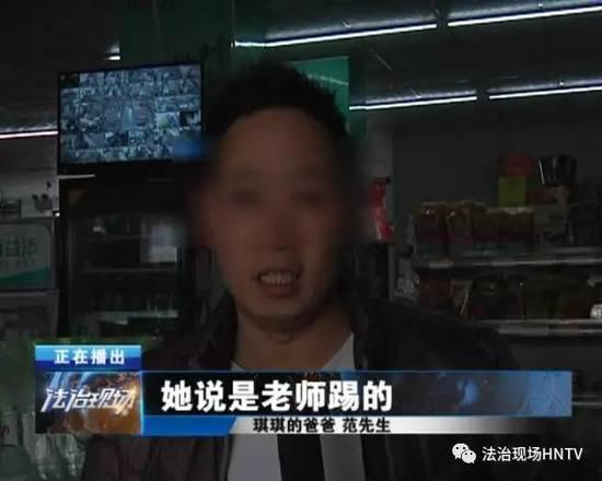 琪琪身上的伤。