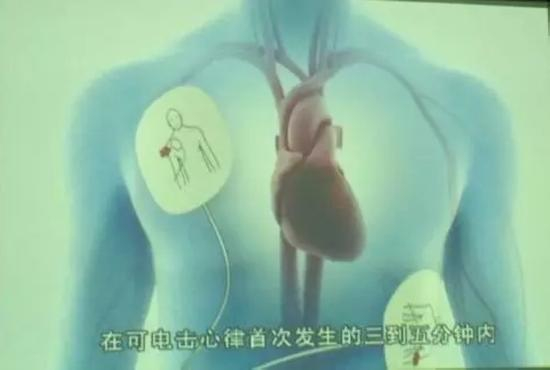 美国心脏协会CPR培训课程。