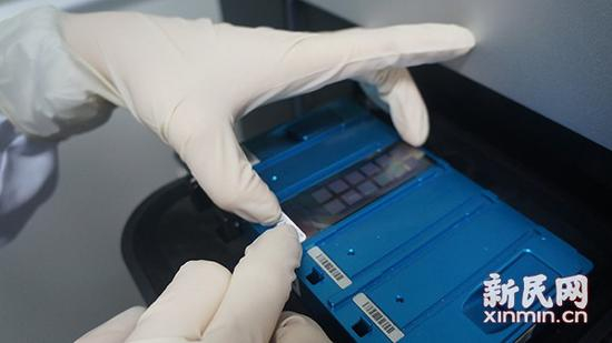  图说：遗传室工作人员正在操作芯片。医院供图&nbsp;&nbsp;