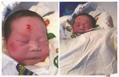  ▲“奇迹宝宝”赵平安&nbsp;