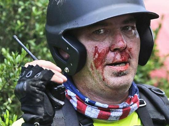 8月12日，美国弗吉尼亚州夏洛茨维尔市李公园入口处，受伤的白人种族主义者用对讲机进行着联络。（新华/美联）