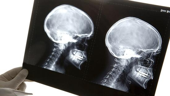 “头颅移植不但在伦理学上不可接受，在科学方面也毫无意义。”