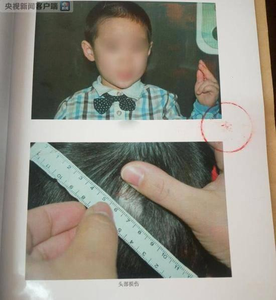 （图片来源于网络）