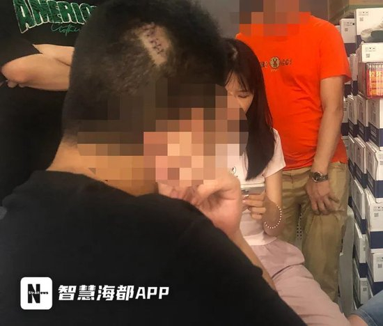 阿宝后脑勺被缝了六针，伤口清晰可见