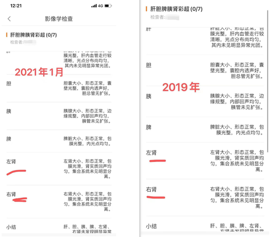 陈洁在2019年、2021年两次体检中腹部彩超均显示双肾正常。本文图片均为受访者供图