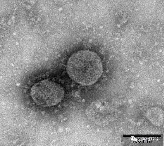  ▲1月27日，国家病原微生物资源库公布首株环境样本分离的新型冠状病毒信息。来自中国疾控中心官网