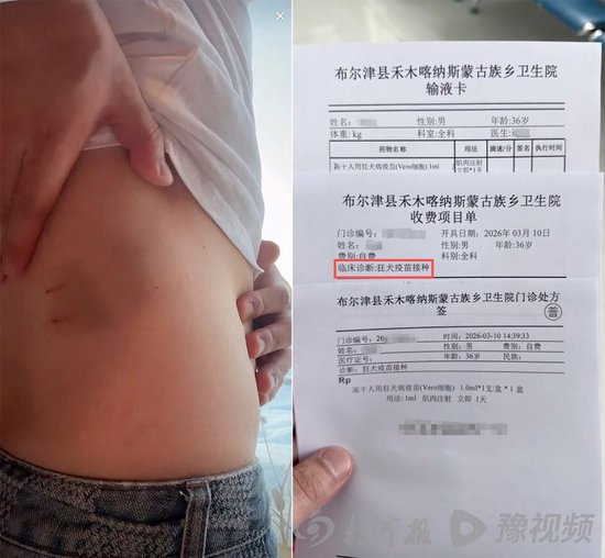 　刘先生展示身上的伤口