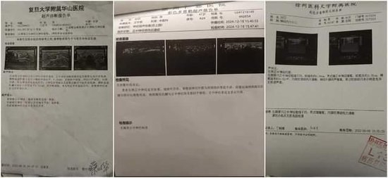 　后续多家医院的检查显示有神经受损