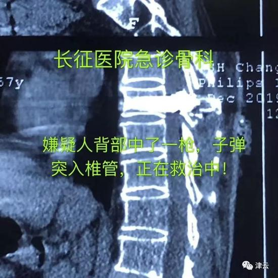  嫌疑人周某的受伤图片