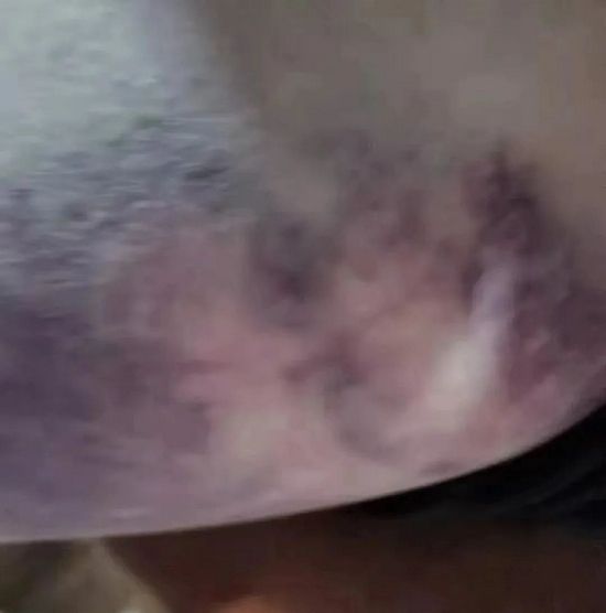 ▲被暴打的孩子照片，家长供图