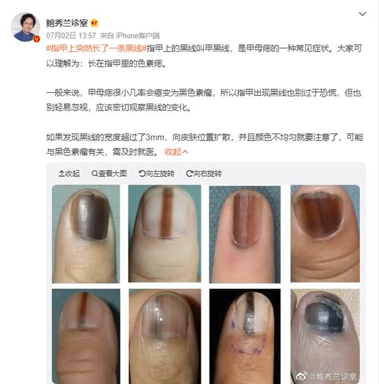 鲍秀兰医生微博截图