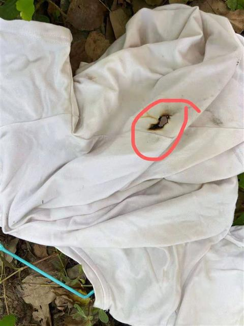 　△罗先生家里就曾出现过扔下的还未完全熄灭的烟蒂引燃衣物的情况。