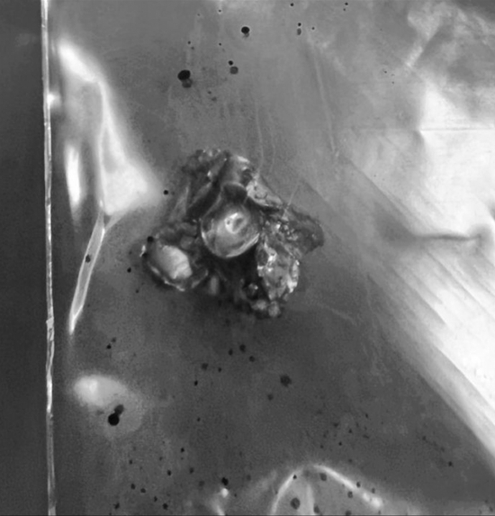 击中游客面部的子弹。