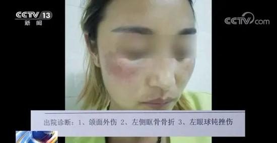  拉姆姐姐卓马被唐路殴打