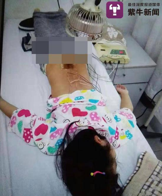 　　在医院做针灸的琪琪