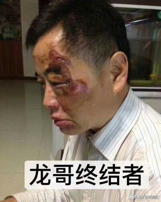 网传龙哥终结者这张照片，昆山市公安局证实为假