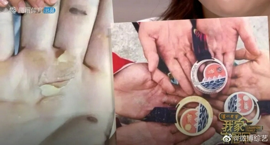  ·赛艇姑娘们的手，让网友看了直呼心疼。