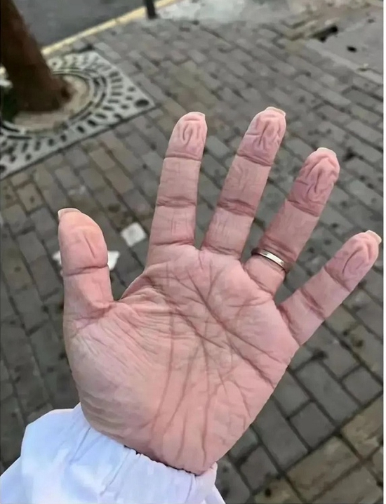  这只手的照片，让不少网友直呼“破防”