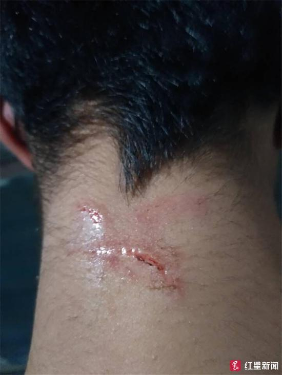 ▲小金后颈的伤痕
