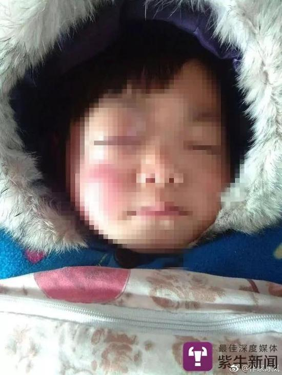 [躺在床上的雅雅]