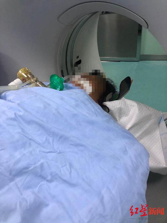  李女士在做检查