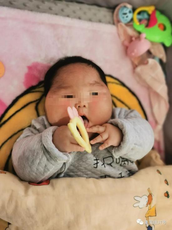 ▲停用益芙灵产品后，柚子体重开始下降，但额头上的汗毛仍未消退。新京报记者 王瑞文 摄