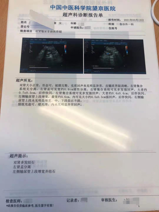  2021年3月13日医院超声检查显示陈洁双肾多发结石&nbsp;
