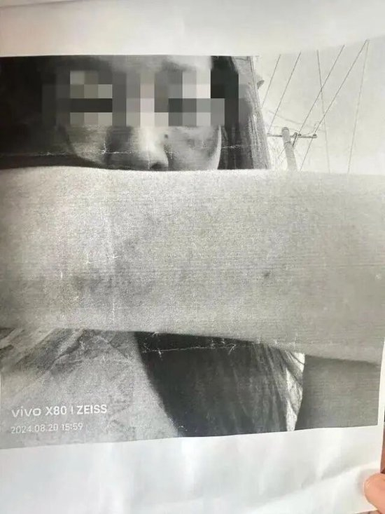 苗苗曾向法院递交被打证据