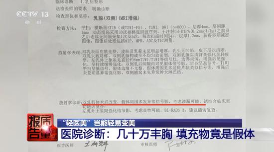 公路警察追捕