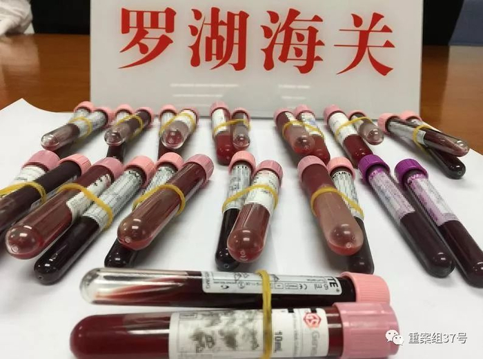  ▲深圳罗湖海关截获的部分人体血液样品。&nbsp;&nbsp;&nbsp;&nbsp;罗湖海关 供图